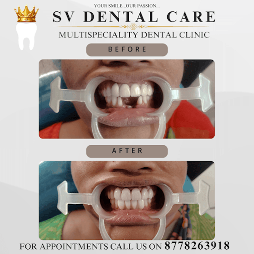 Modern dental treatment room in Salem Tamil Nadu