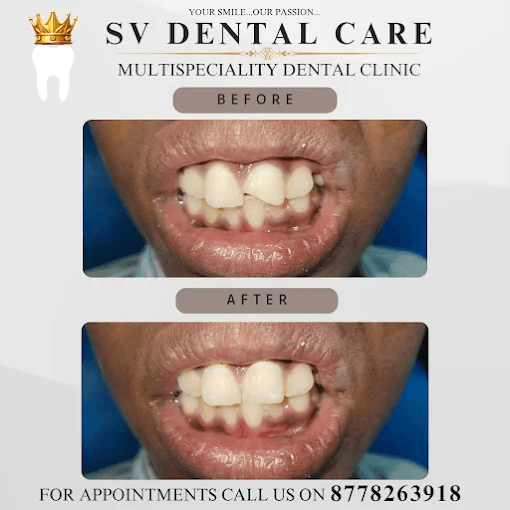 Comfortable patient waiting area at dental clinic in Salem